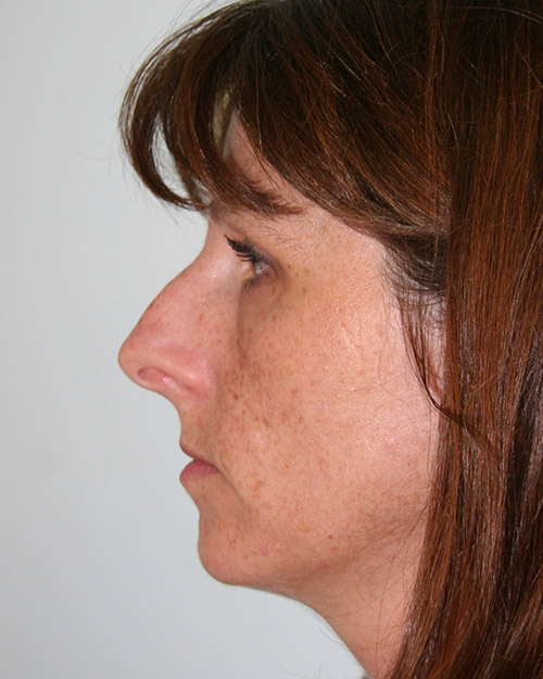 gal-image