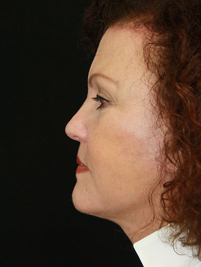 gal-image