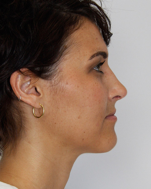 gal-image