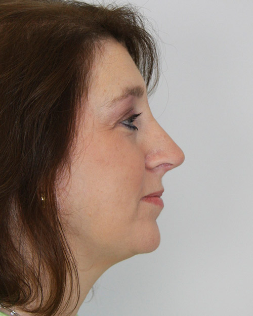 gal-image