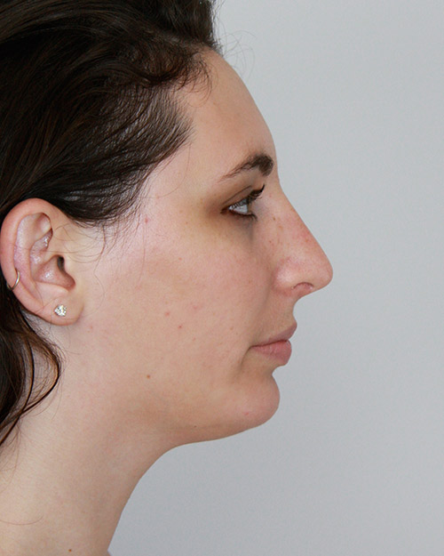 gal-image