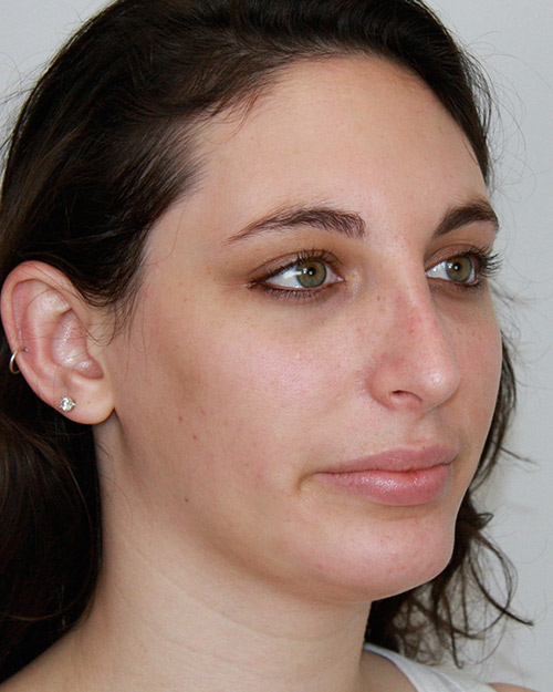 gal-image