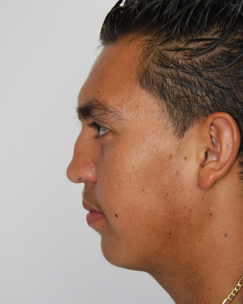 gal-image