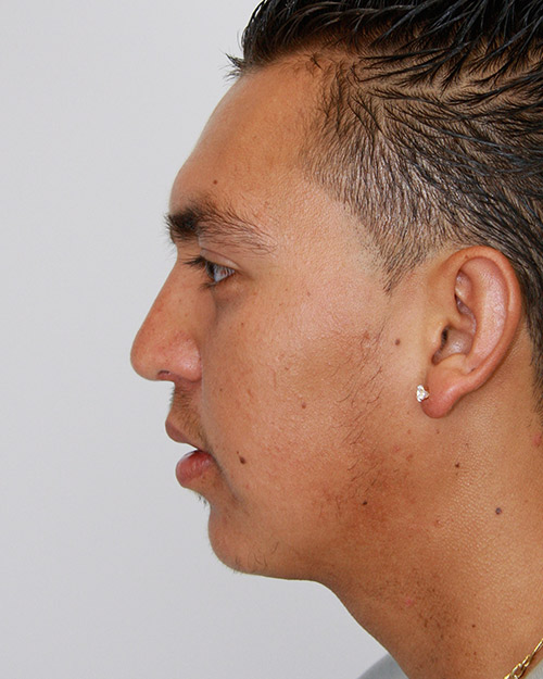 gal-image