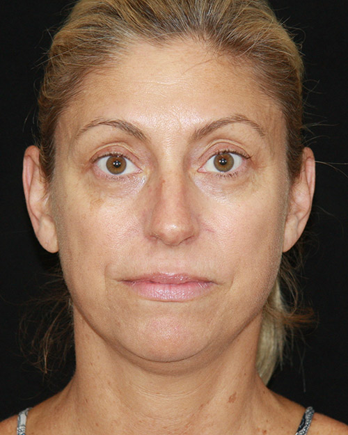 gal-image