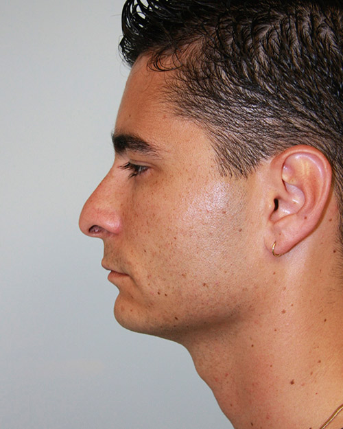 gal-image
