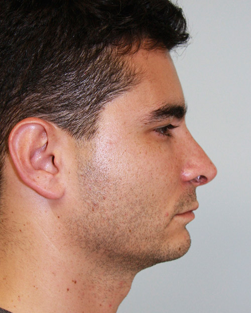 gal-image