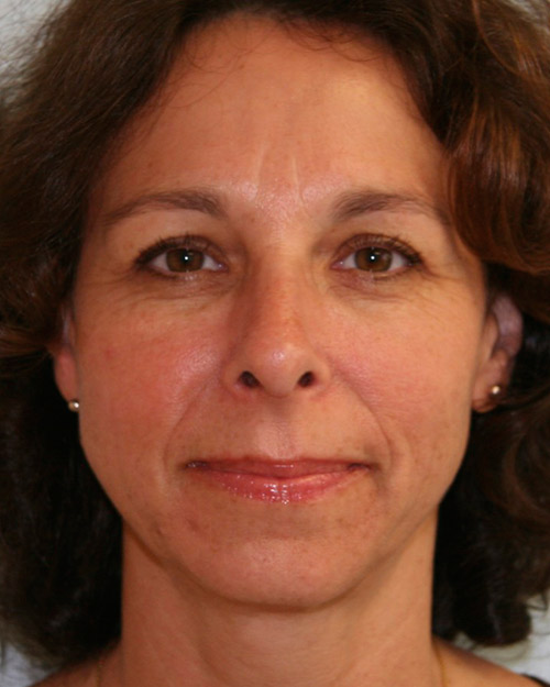 gal-image
