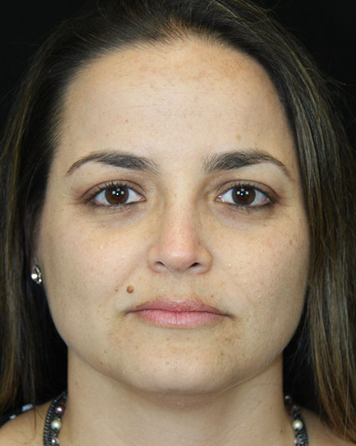 gal-image