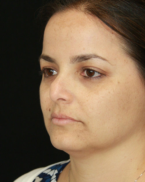 gal-image