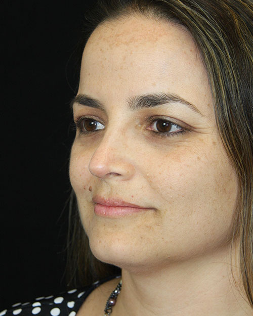 gal-image