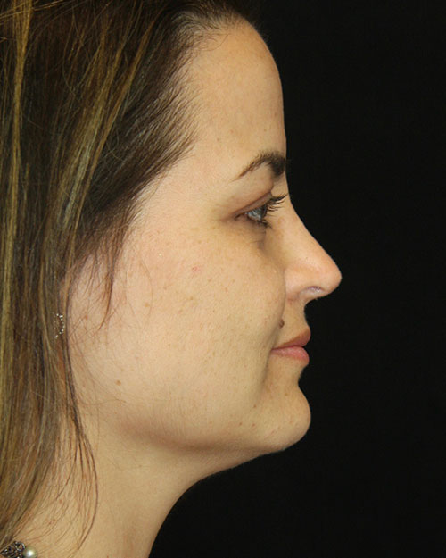 gal-image