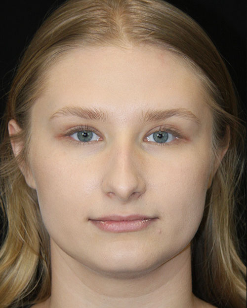 gal-image