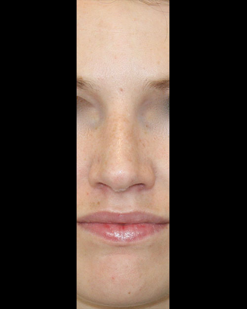 gal-image