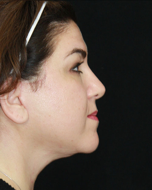 gal-image