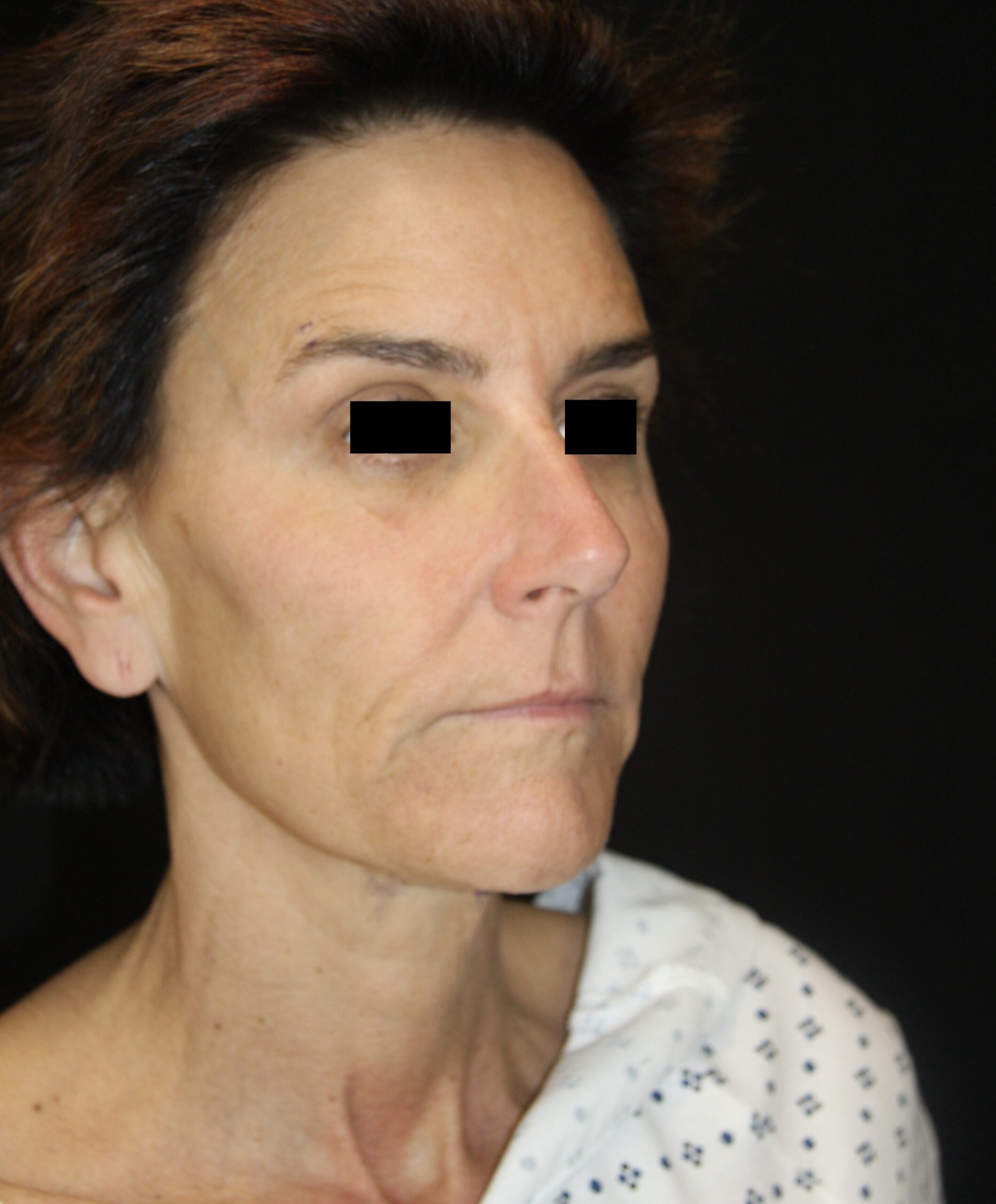 gal-image