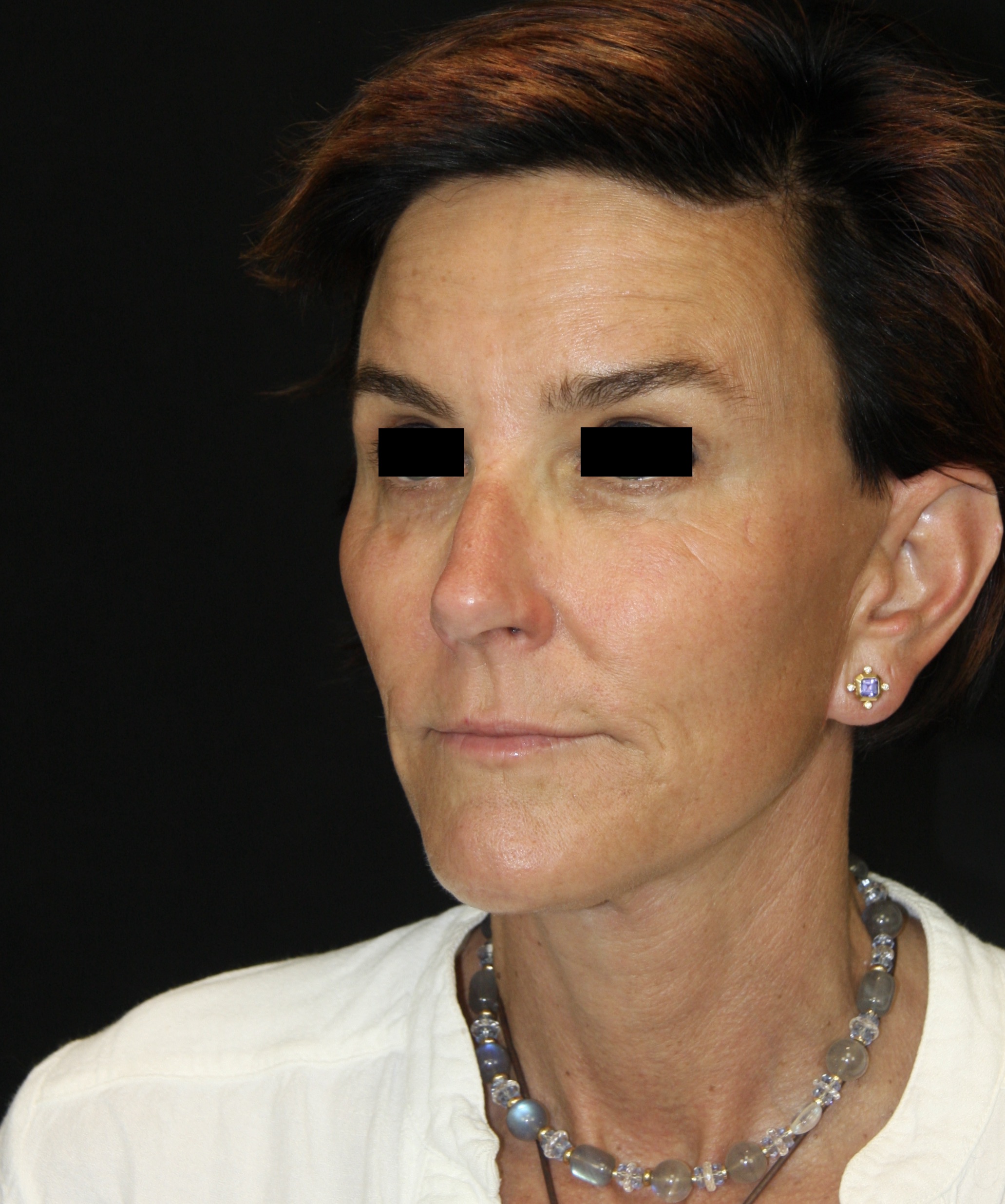 gal-image