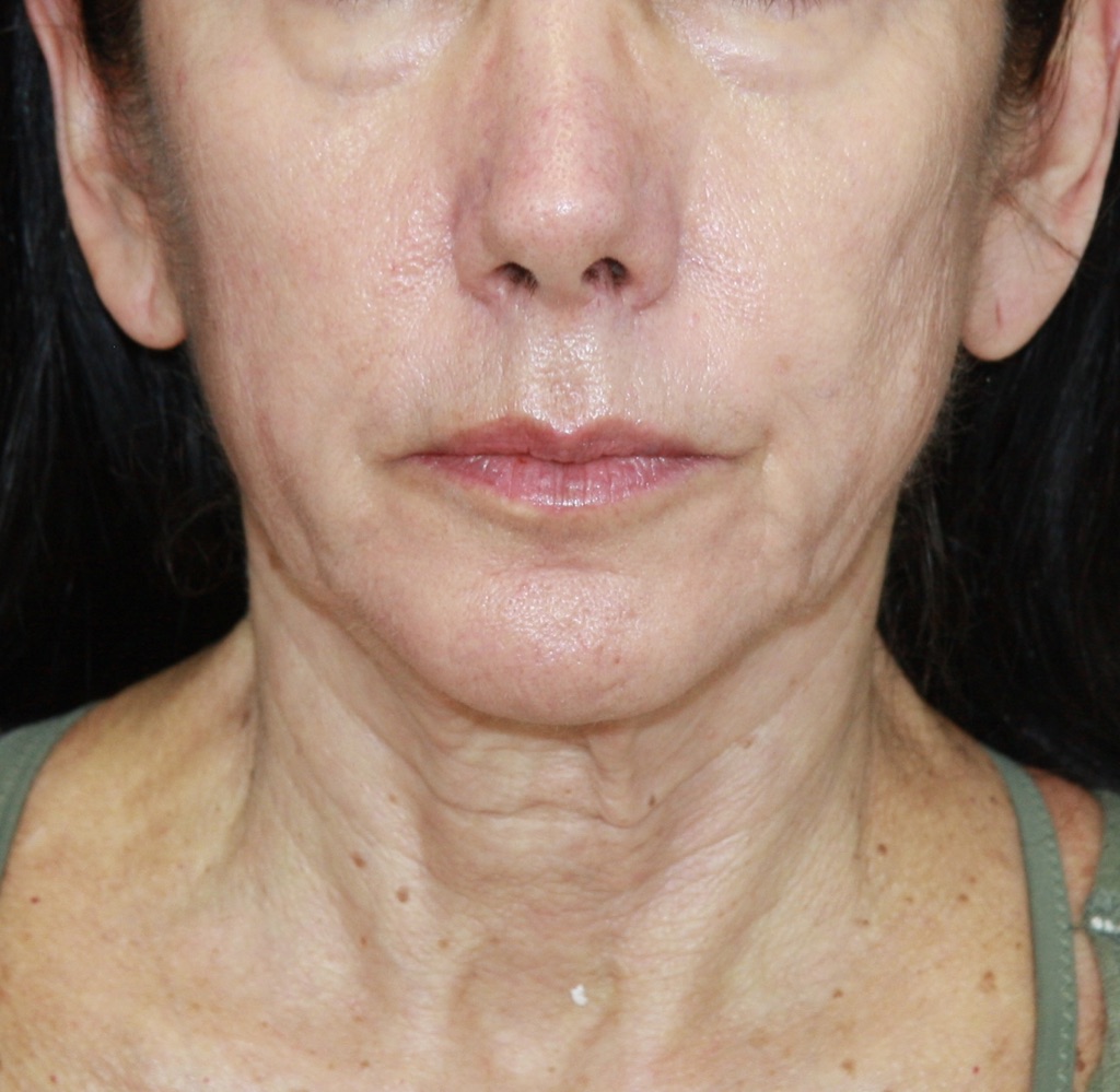 gal-image