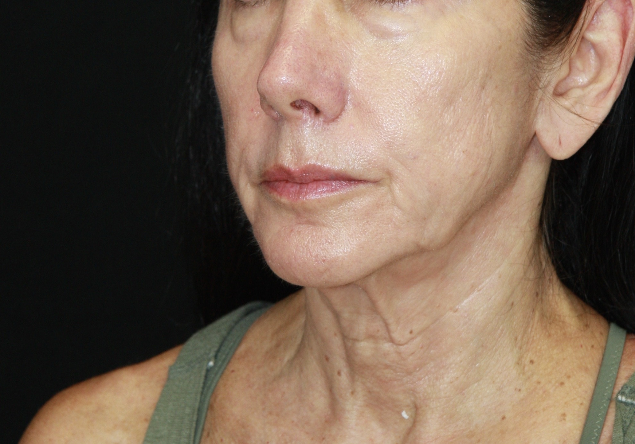 gal-image