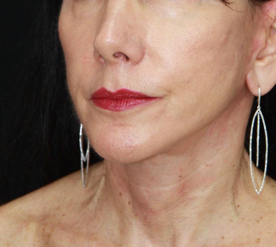 gal-image