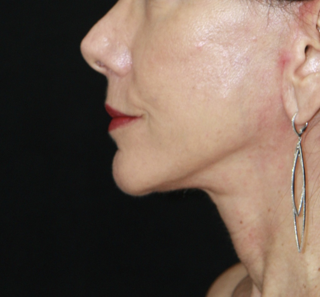 gal-image