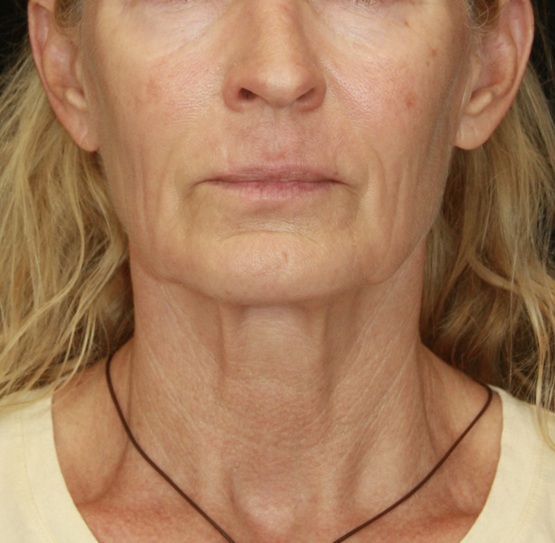 gal-image