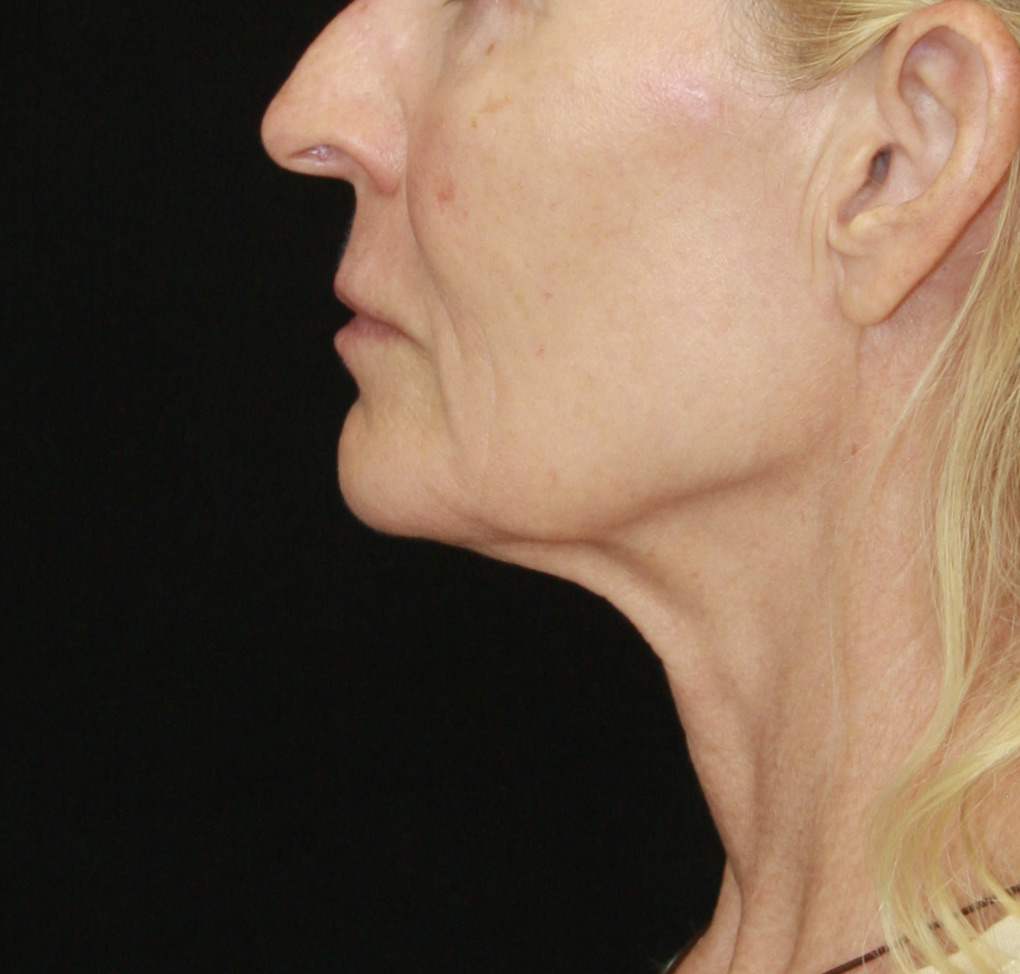gal-image