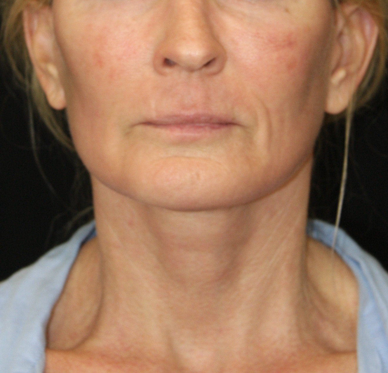 gal-image
