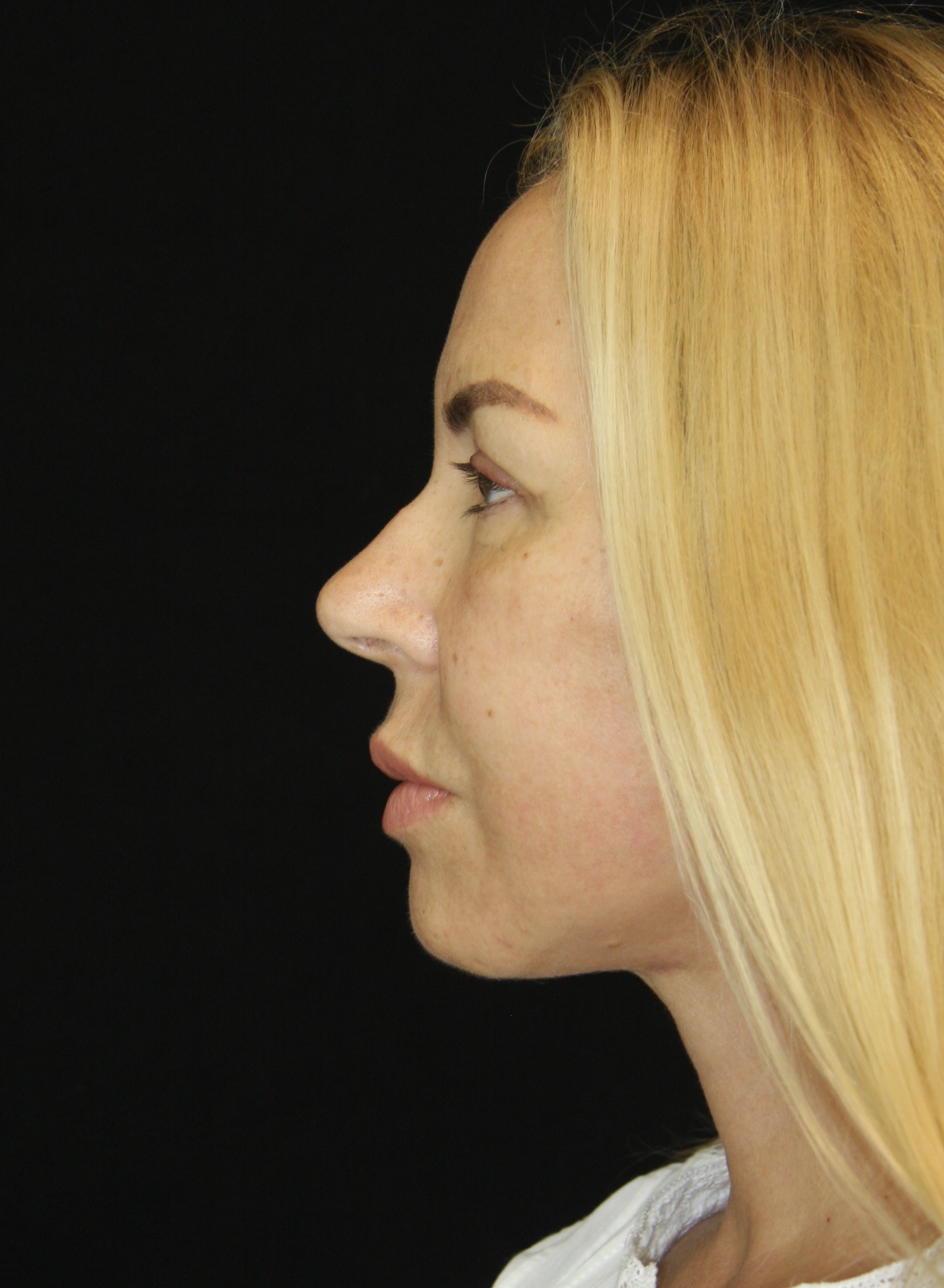 gal-image
