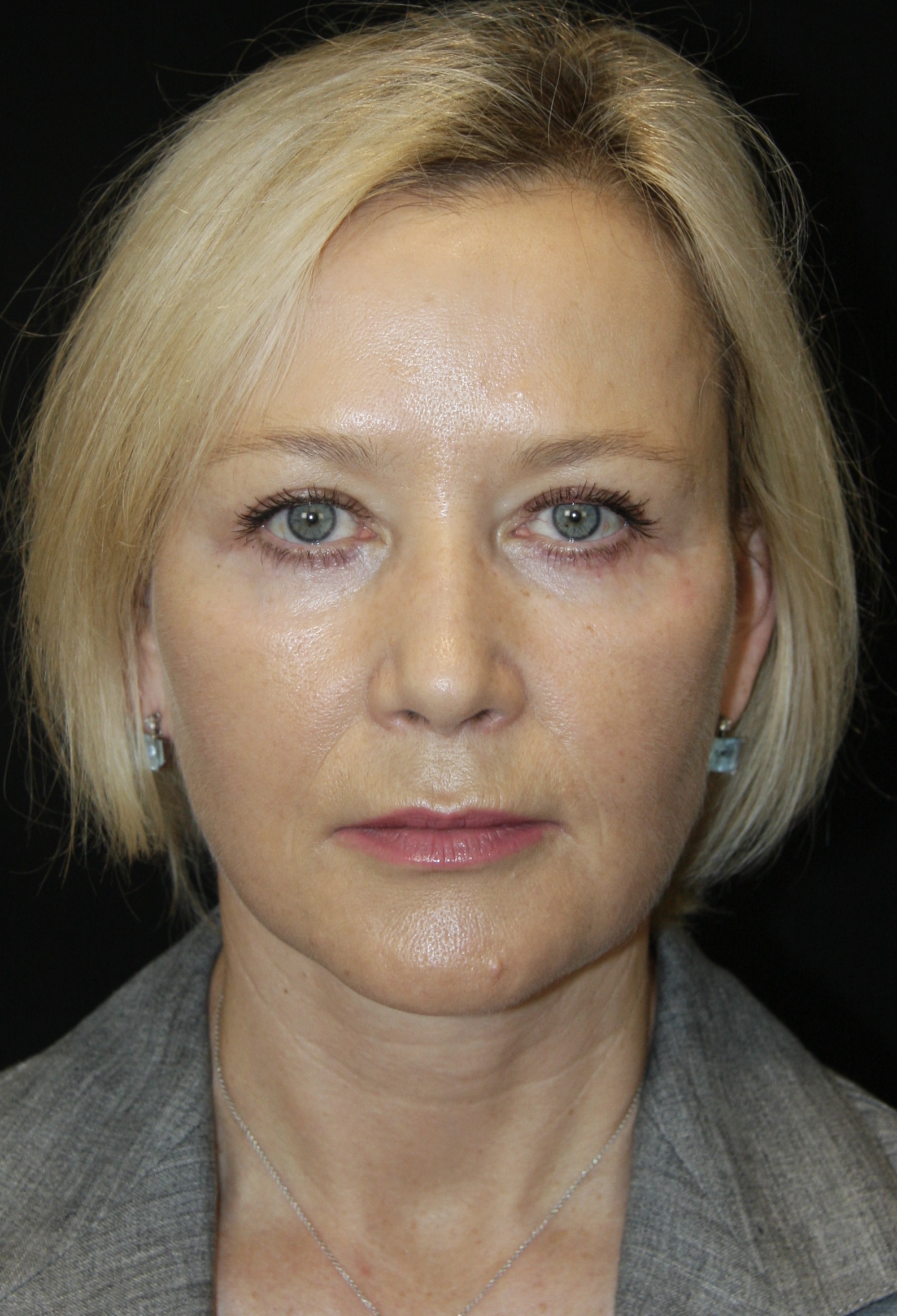 gal-image