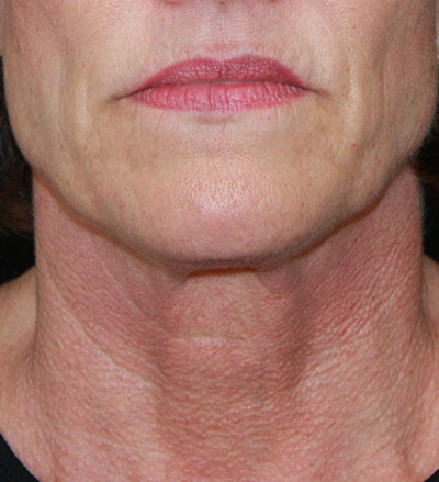 gal-image