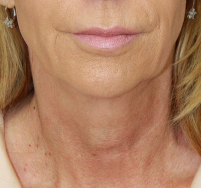 gal-image