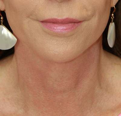 gal-image