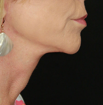 gal-image