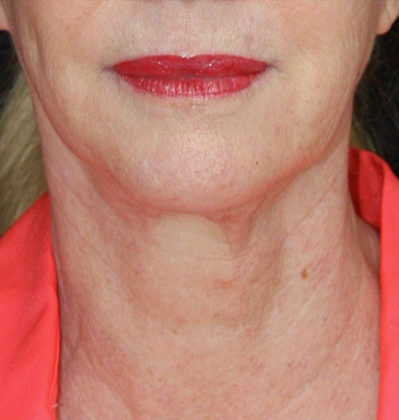 gal-image