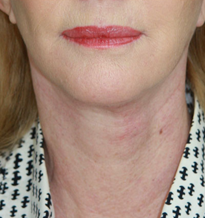 gal-image