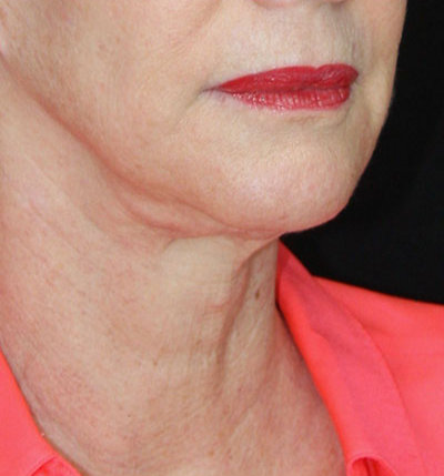 gal-image