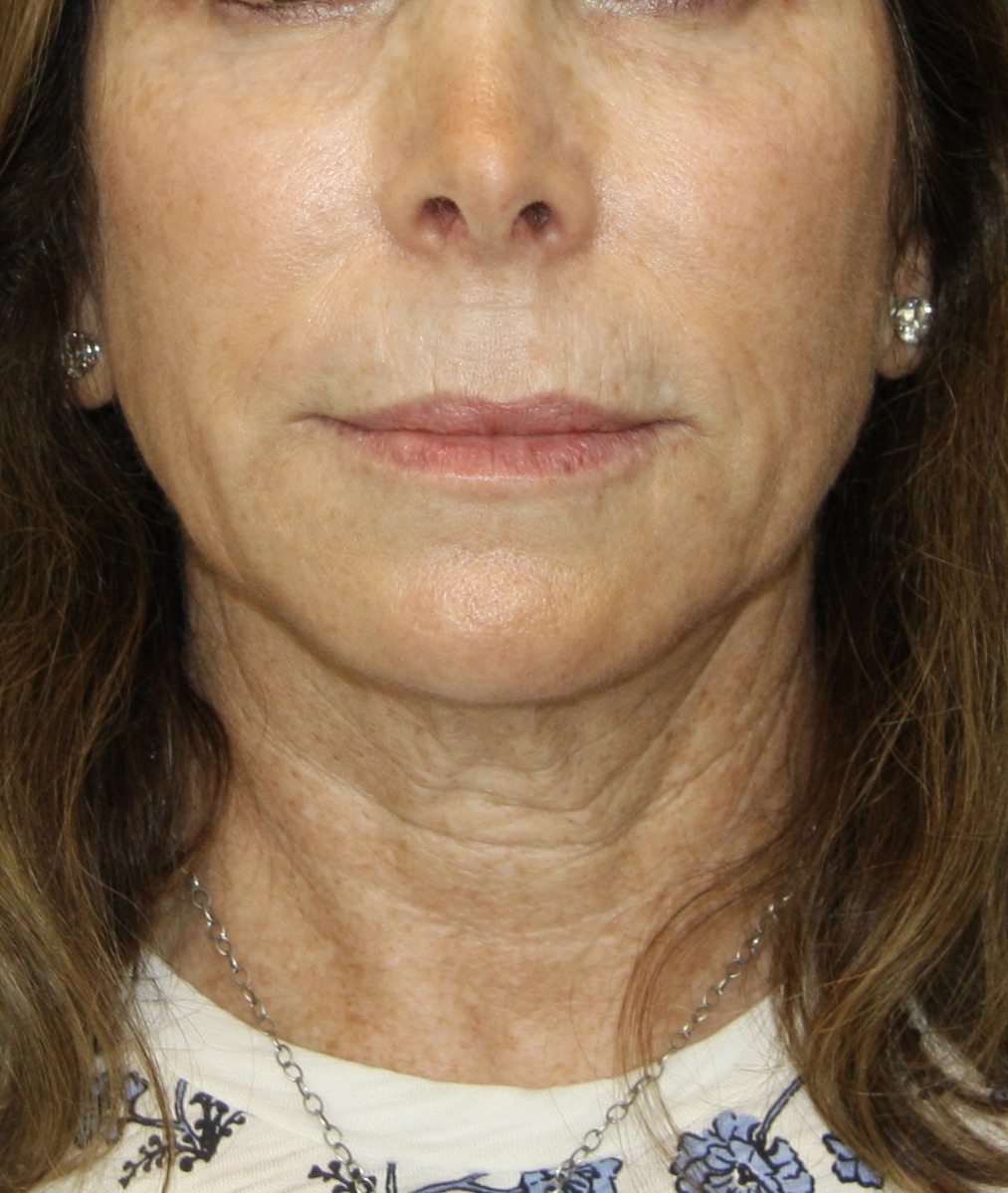 gal-image
