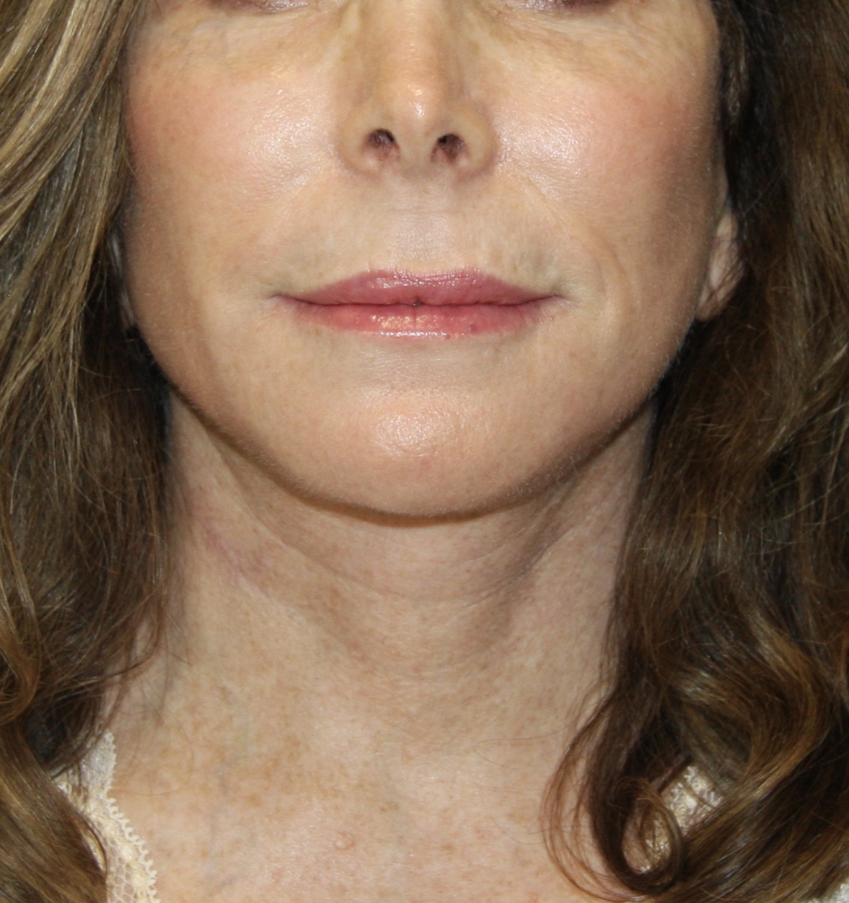 gal-image