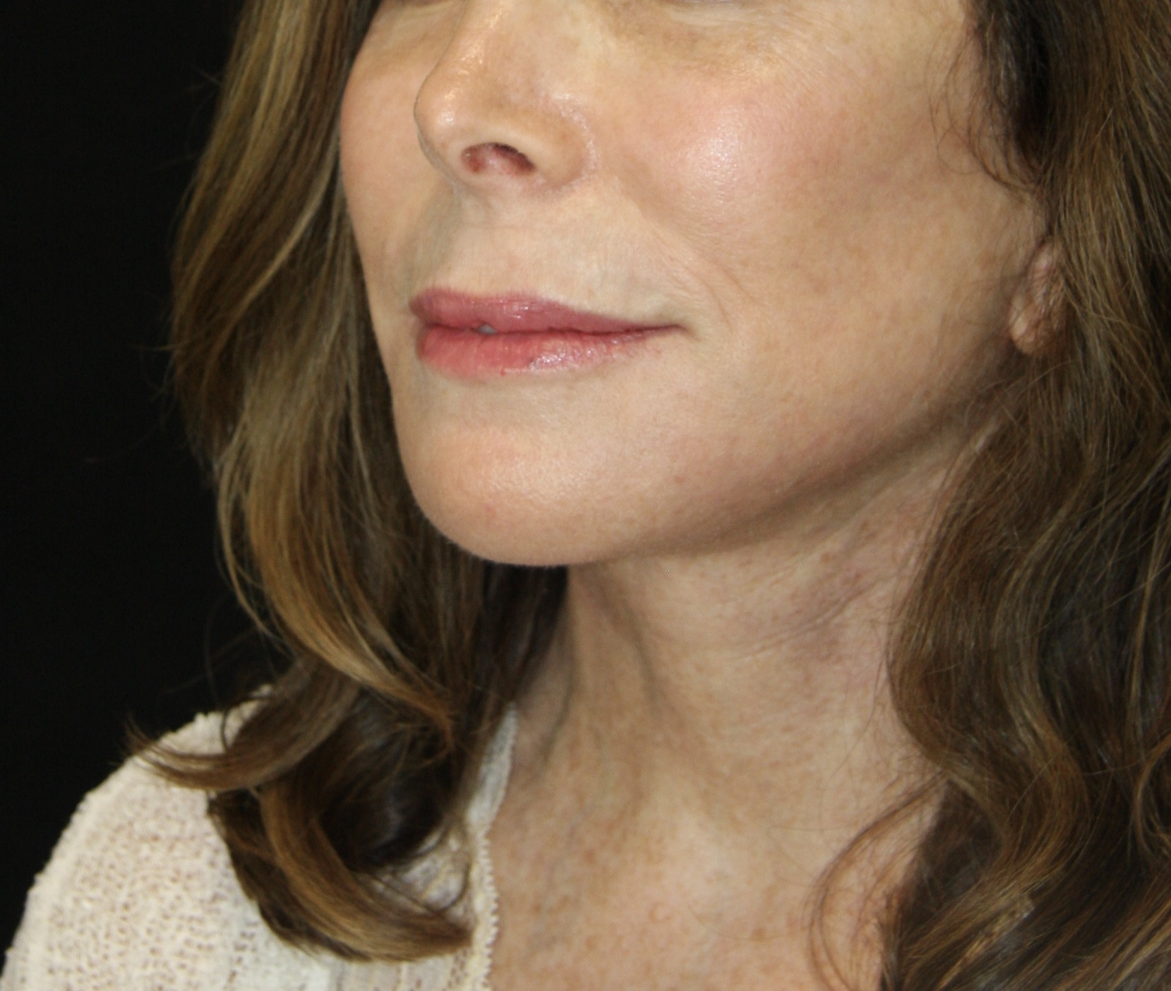 gal-image