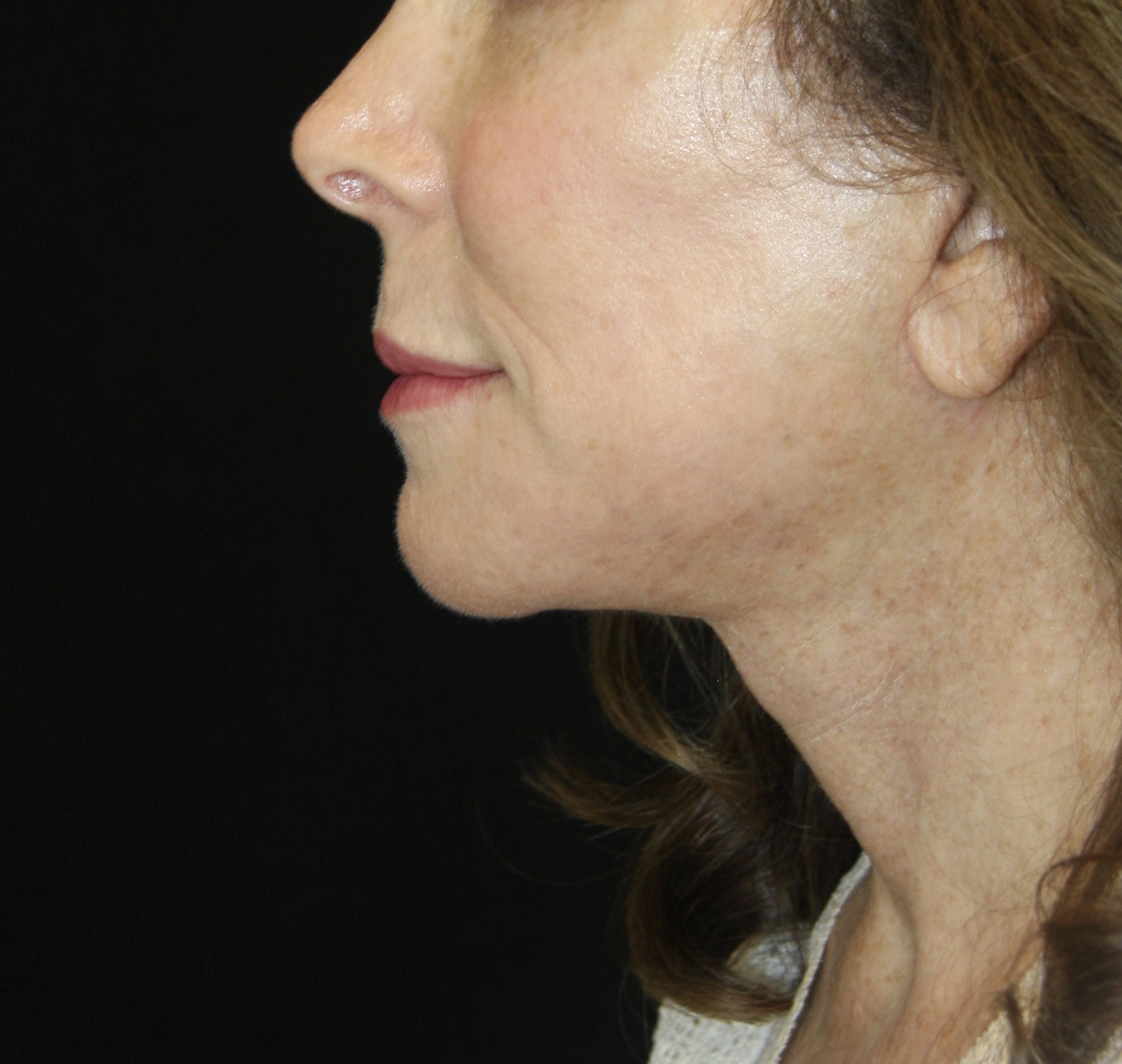 gal-image