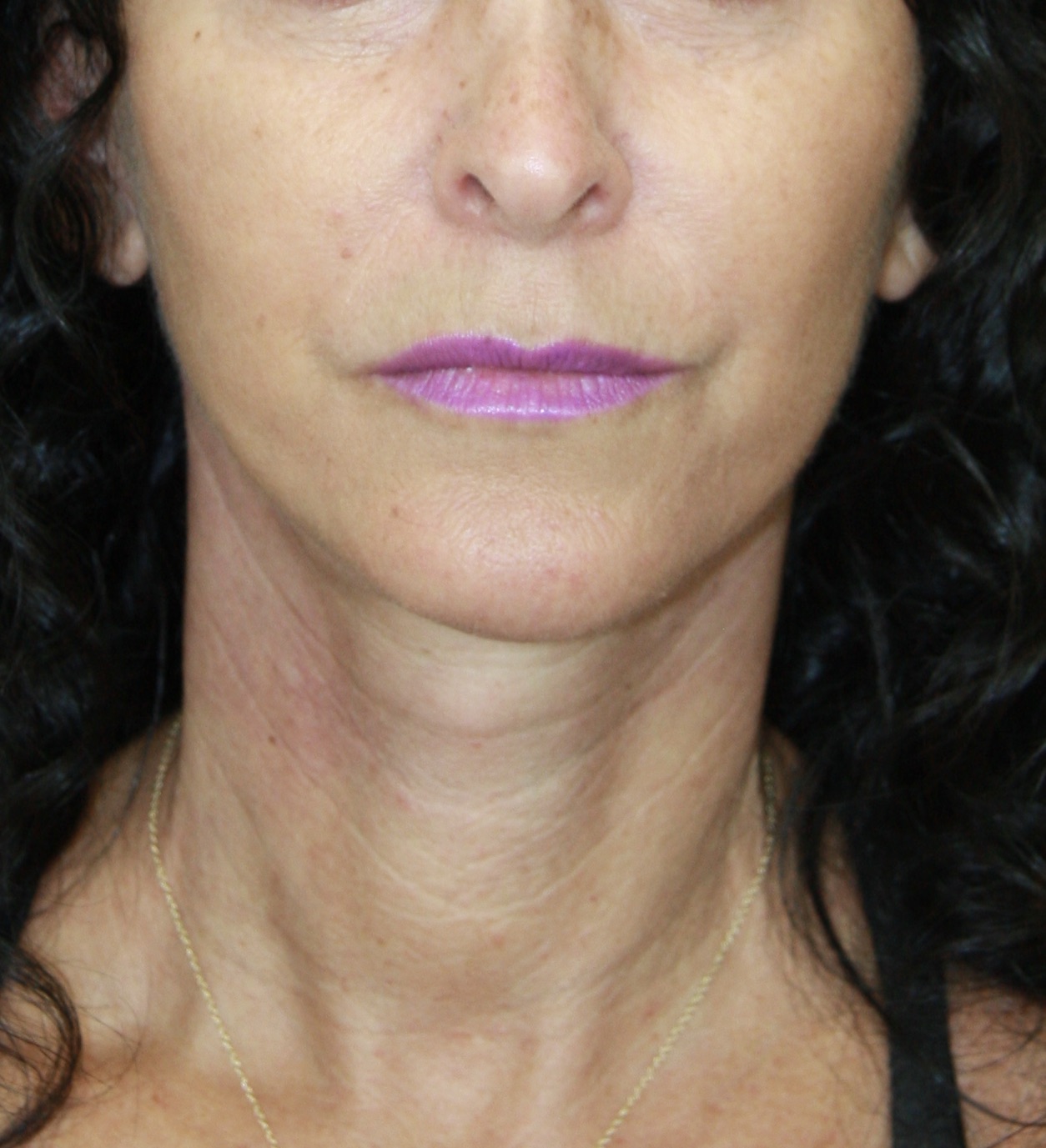gal-image