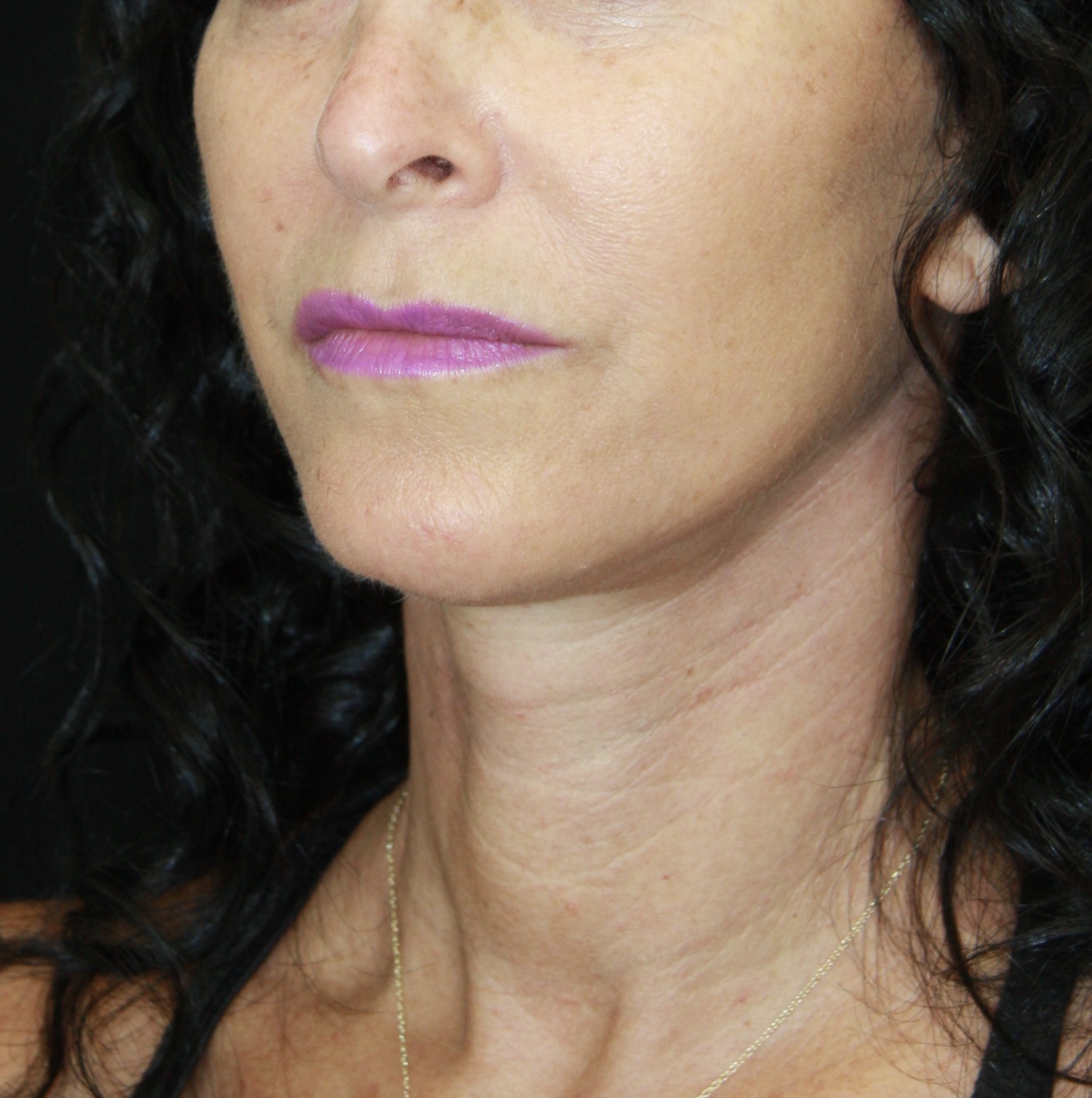 gal-image