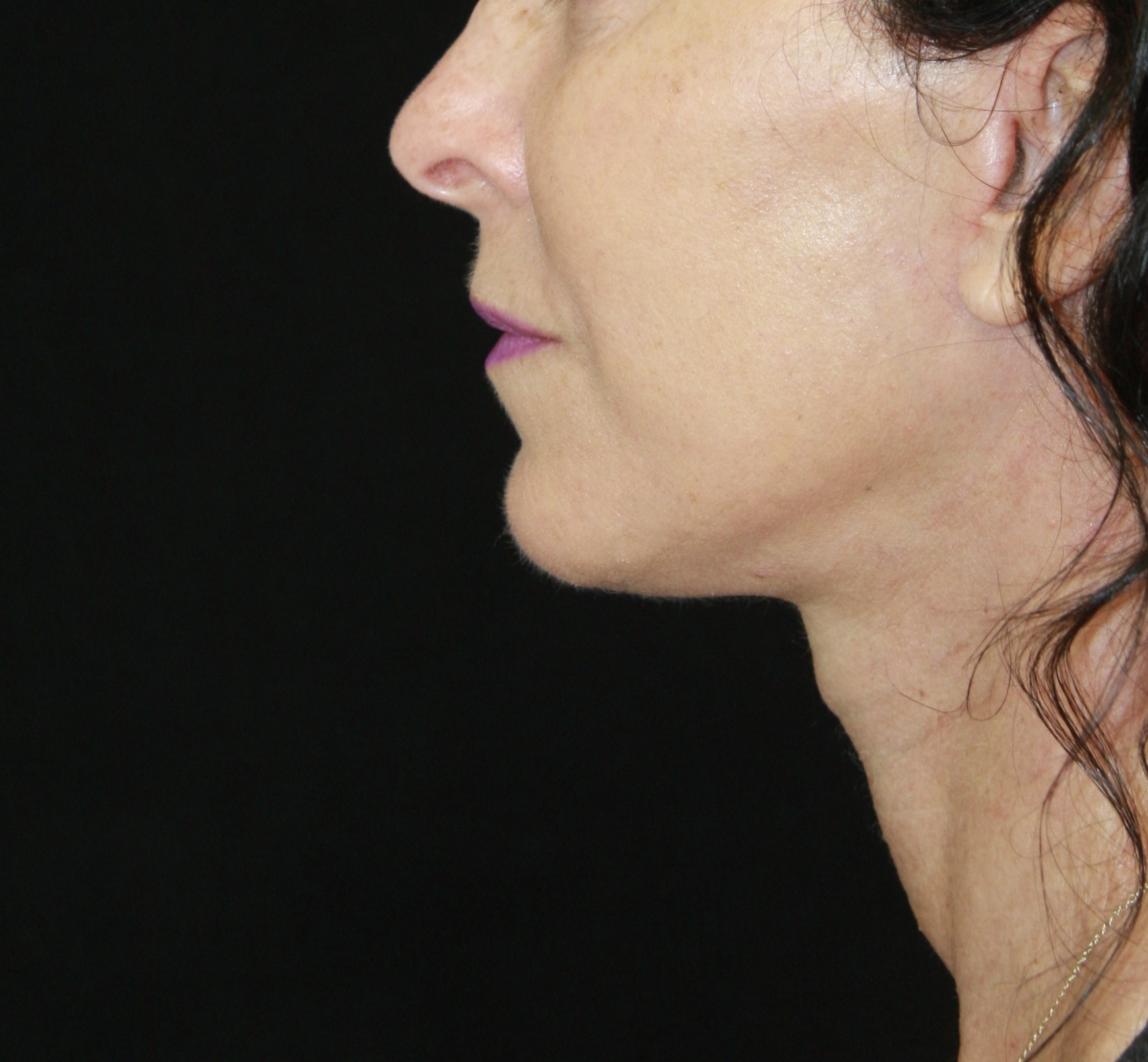 gal-image
