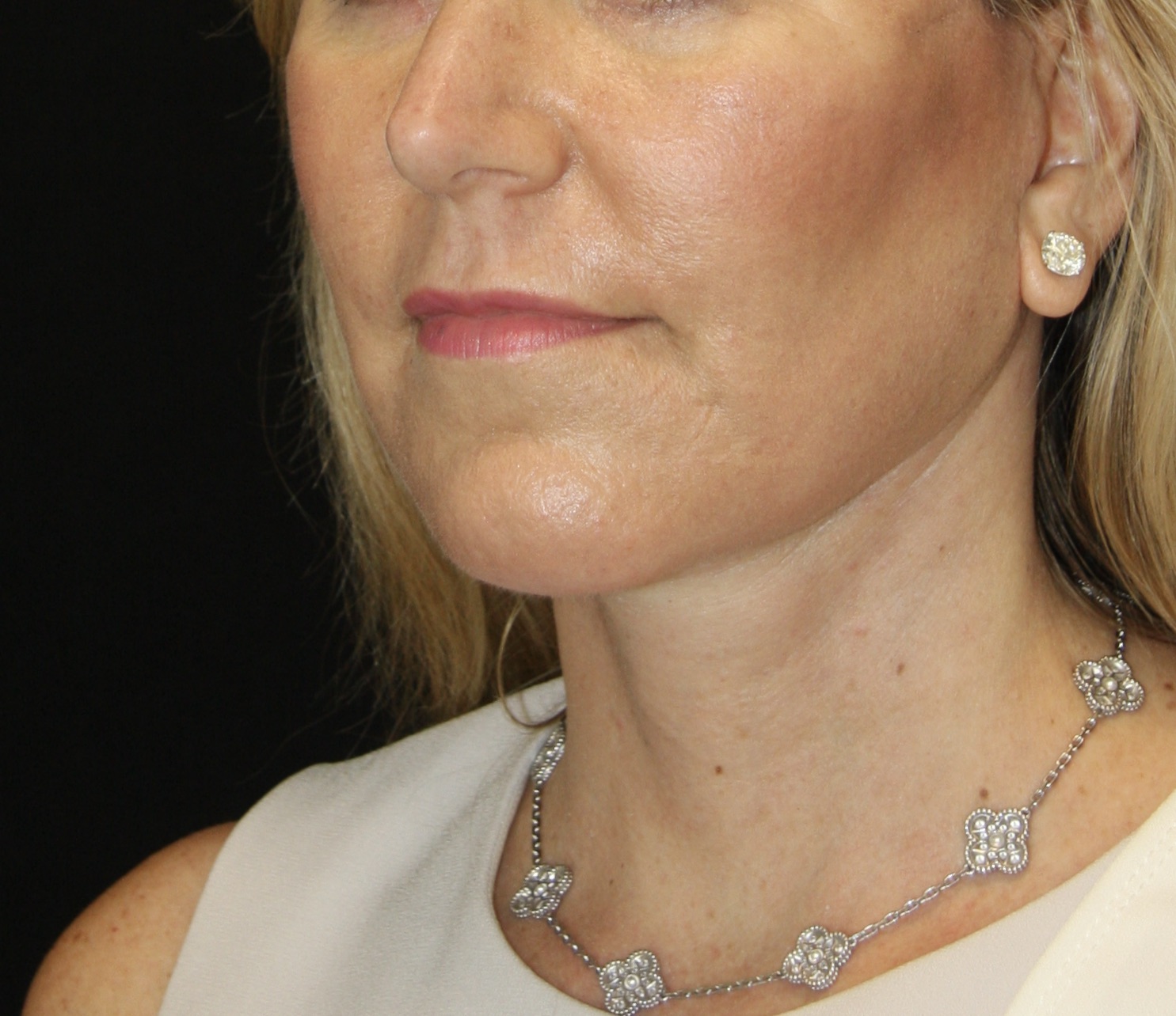 gal-image