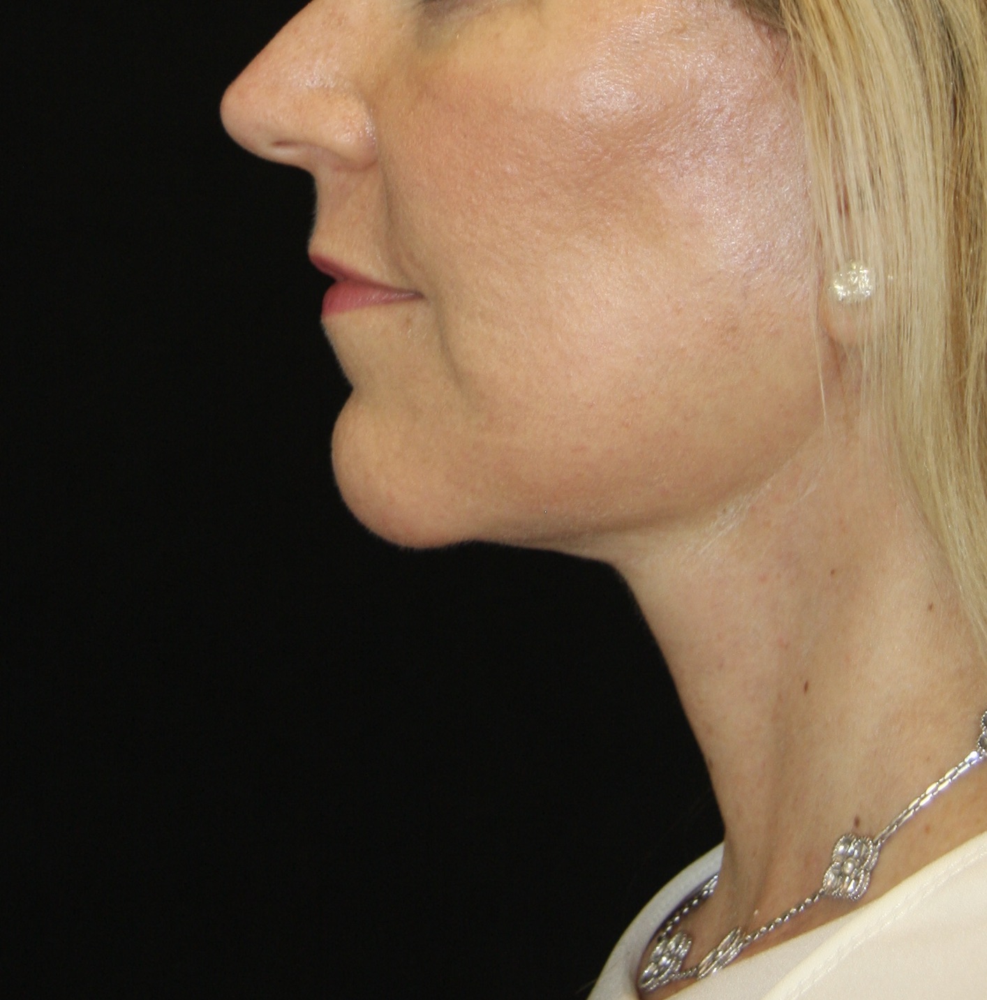 gal-image