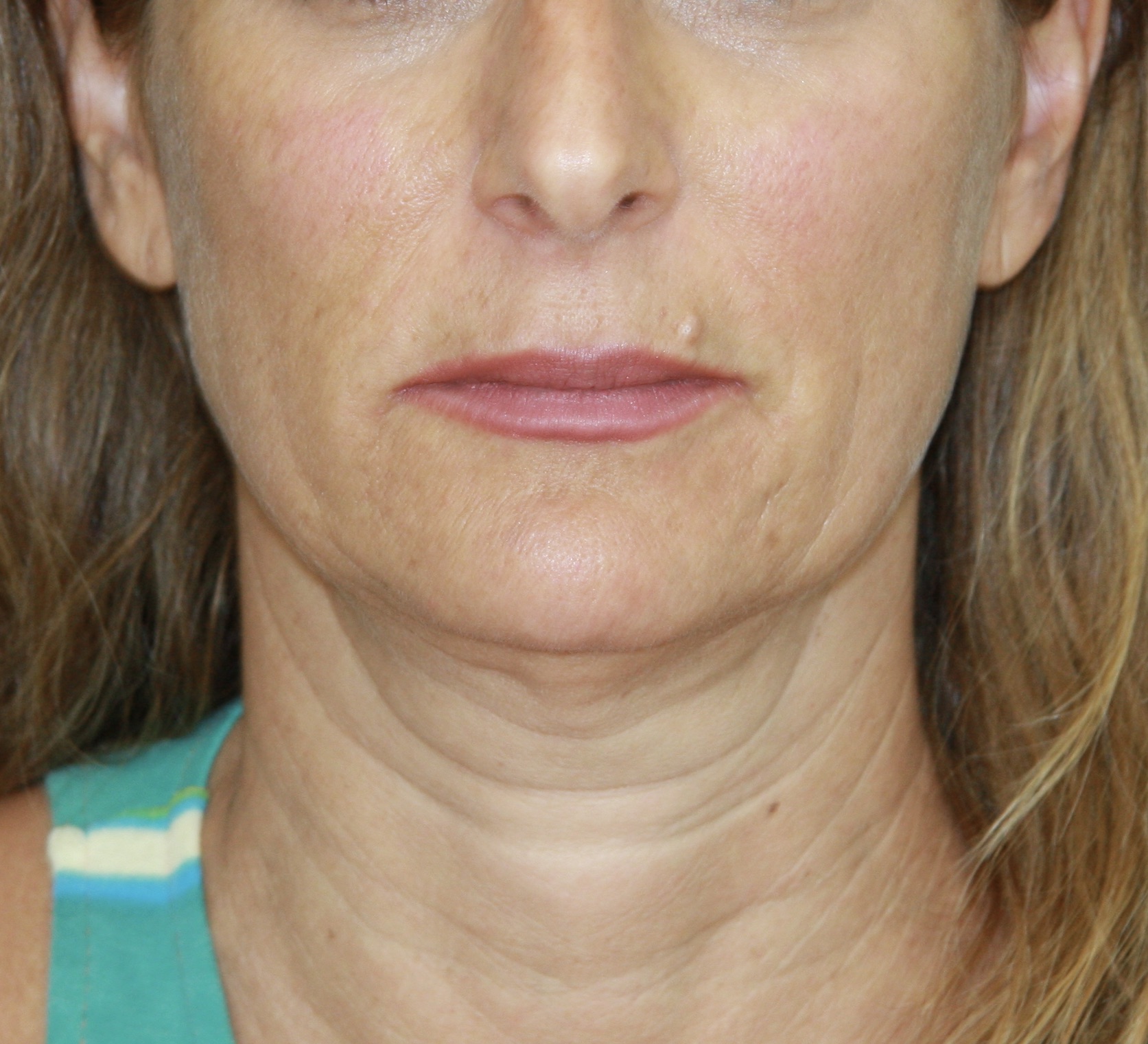 gal-image