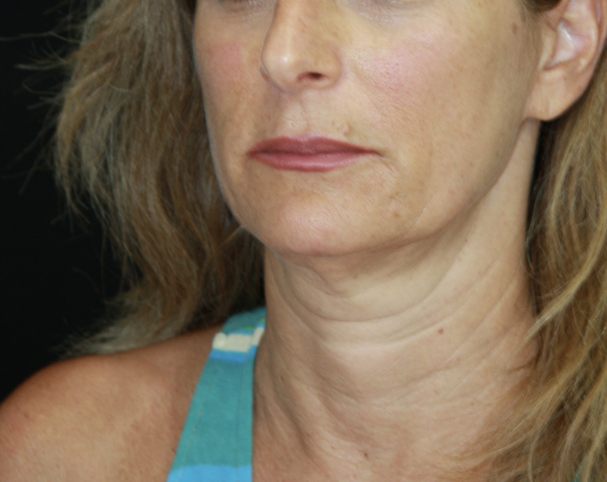 gal-image