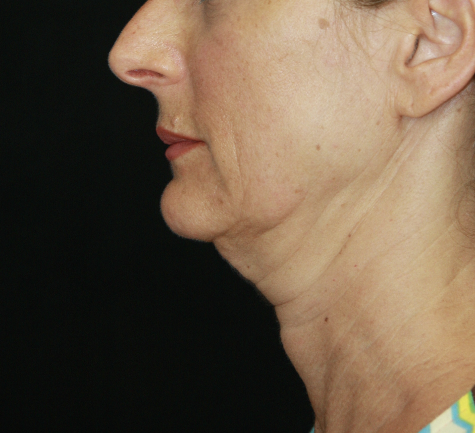 gal-image