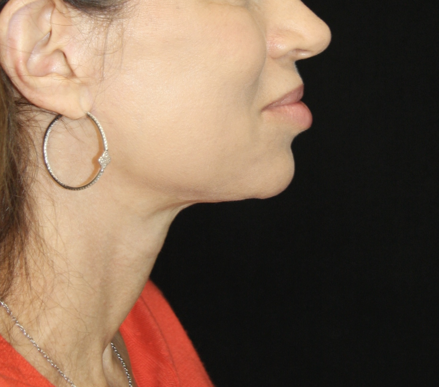 gal-image
